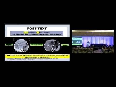 US03: Pediatric Liver Transplantation: Resection vs Transplantation for Advanced Hepatoblastoma 